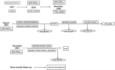 Acne caused by ziprasidone in a young patient with bipolar disorder: A case report